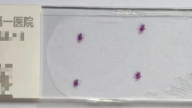 【泉一有普】顯微鏡下的生命哨兵：病理科如何鎖定早期胃癌